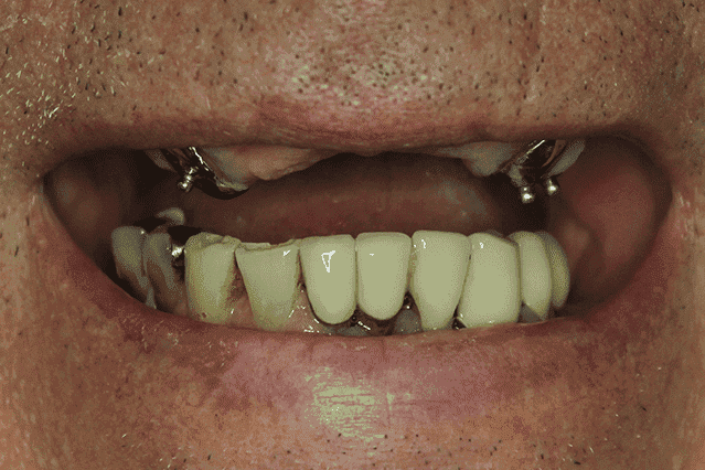 Before