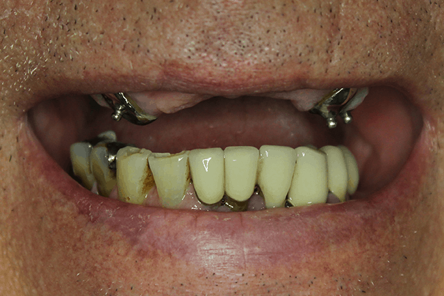 Before