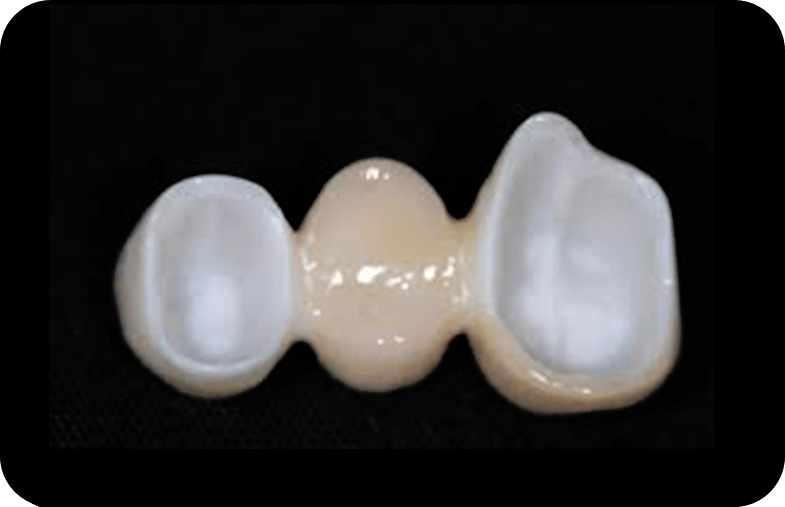 Bridge de zirconium Espagne 