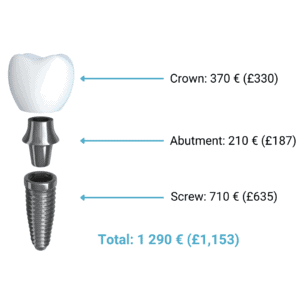 dental implant const