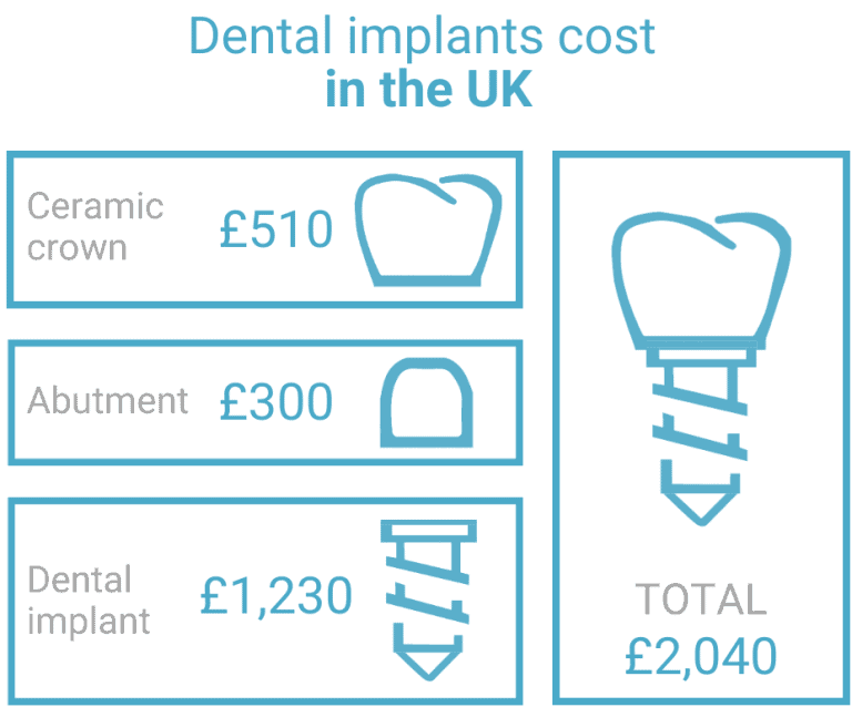 Can I get dental implants on the NHS? El Cedro Barcelona