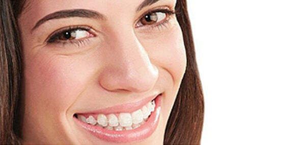 photo sourire
