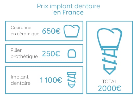 Couronne dentaire : pose, prix et remboursement